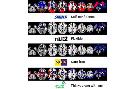 NeuroBranding - Hoe worden merkassociaties gemeten_ fMRI scans