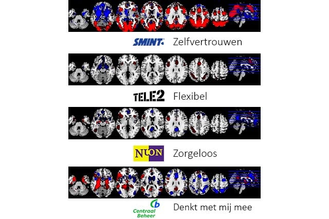 NeuroBranding - Hoe worden merkassociaties gemeten? fMRI scans