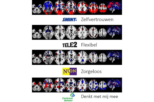 NeuroBranding Hoe worden merkassociaties gemeten fMRI scans