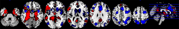 Oplossing_Merkonderzoek_Neural_Brand_Signature_CB_v2-1