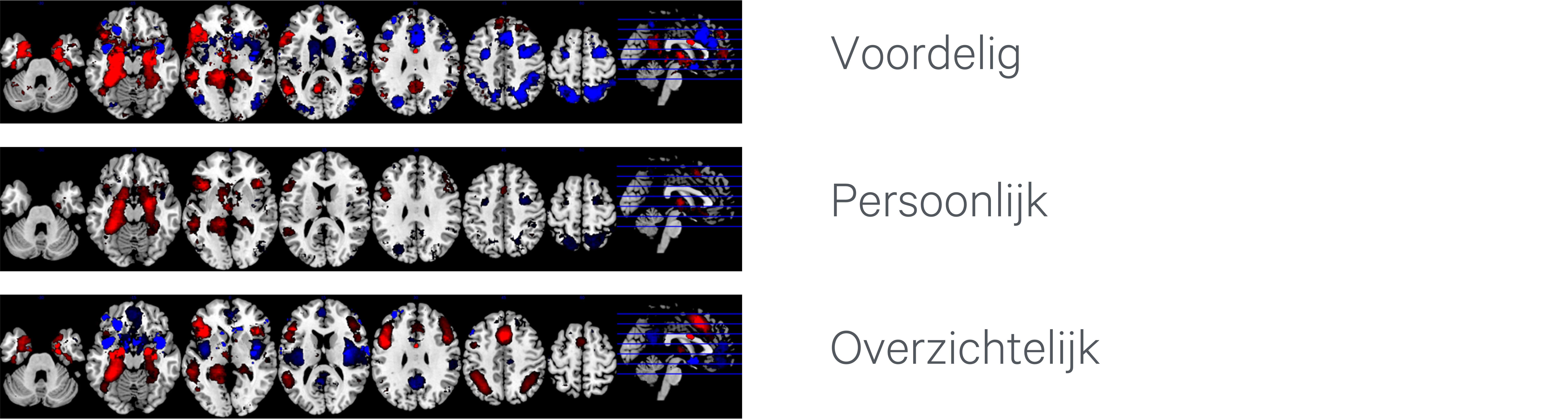 associaties in het brein